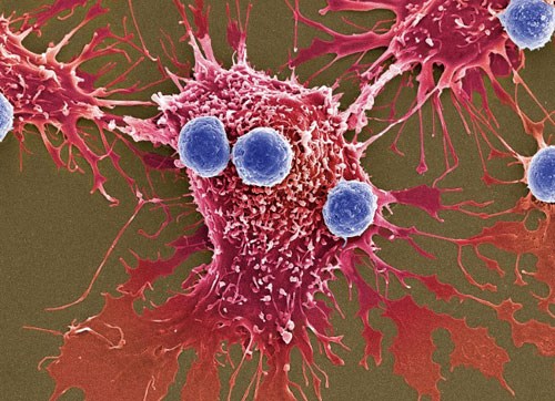 Nhiều kỳ vọng vào biện pháp mới điều trị ung thư - Anh 1
