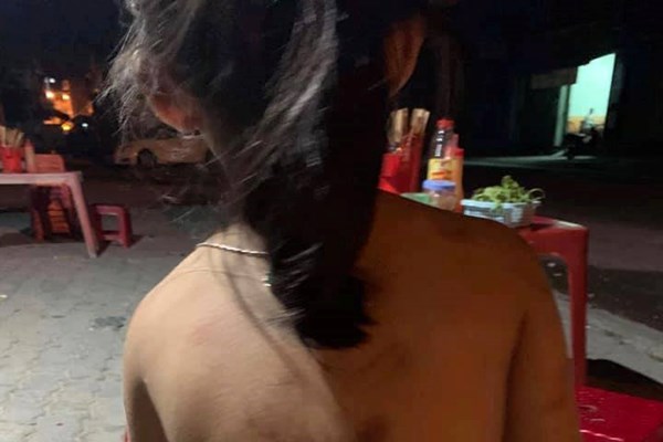 Xác minh thông tin cháu gái 6 tuổi ở Quảng Nam bị bà đánh thâm tím mình mẩy - Anh 1
