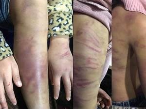 Hà Nội: Khẩn trương làm rõ bé gái 12 tuổi bị mẹ bạo hành - Anh 1