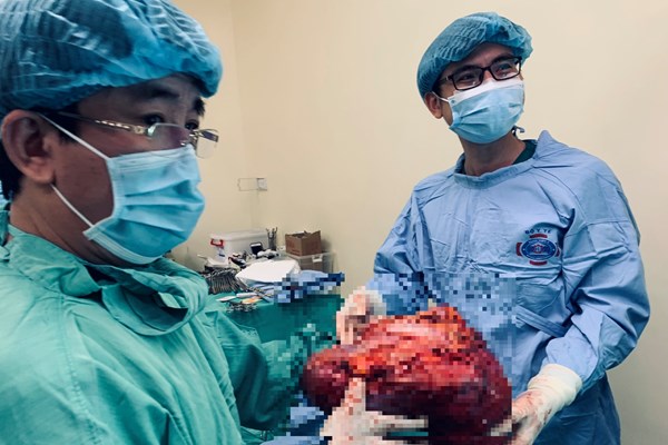 Phẫu thuật thành công cho bệnh nhân nặng 39kg mang khối u 6,5 kg - Anh 1