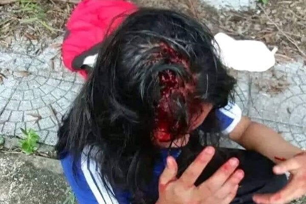Thừa Thiên Huế: Liên tiếp nhiều vụ nữ sinh đánh nhau, báo động nạn bạo lực học đường - Anh 2