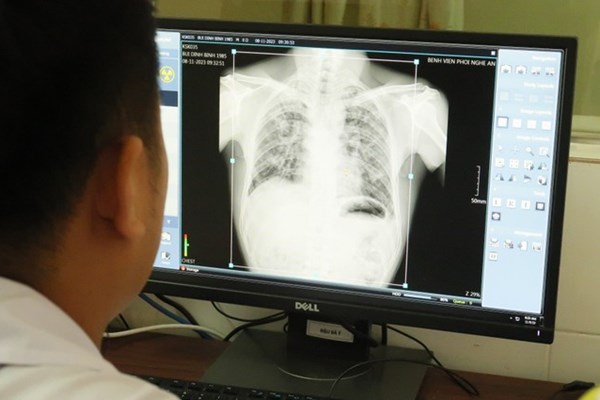 Vụ 6 công nhân tử vong do bụi phổi: Phát hiện thêm hàng chục người mắc bệnh - Anh 1