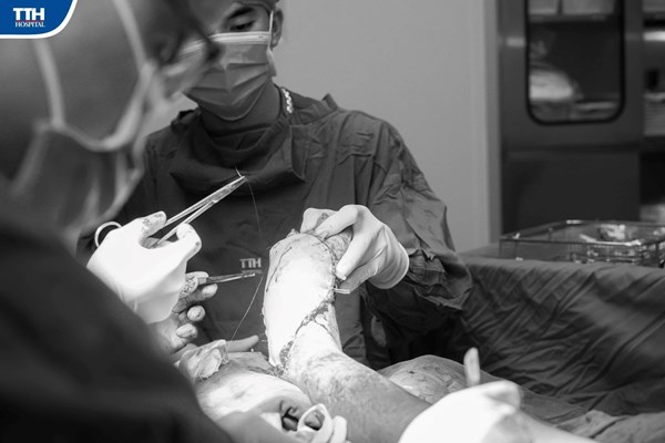 Quảng Bình: Lần đầu tiên thực hiện chuyển vạt da vi phẫu cứu bệnh nhân - Anh 2
