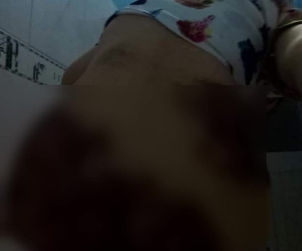 Tây Ninh: Điều tra vụ một phụ nữ nghi bị chồng bạo hành dã man - Anh 1