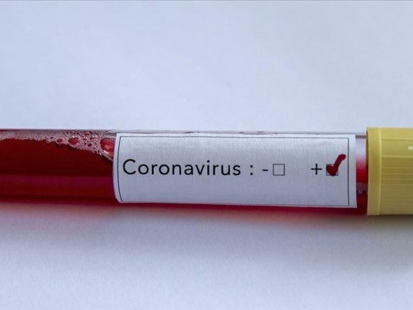 Hà Lan ghi nhận ca nhiễm Covid-19 đầu tiên - Anh 1