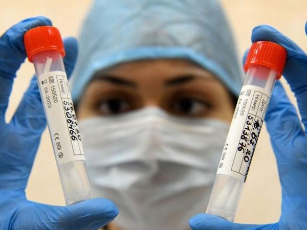 Nga sẽ bắt đầu sản xuất vaccine ngừa Covid-19 vào tháng 11 - Anh 1