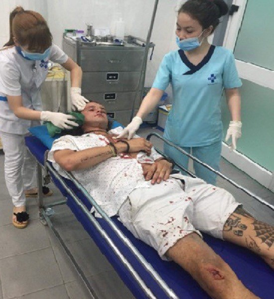 Vụ khách nước ngoài bị đánh phải nhập viện tại Hội An( Quảng Nam): Triệu tập lái xe ôm đến làm việc - Anh 1