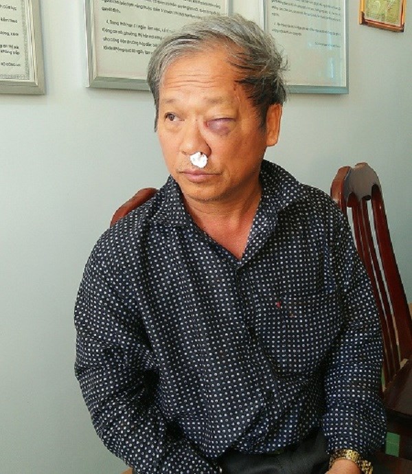 Kon Tum:  Phóng viên VTV bị hành hung phải nhập viện - ảnh 1