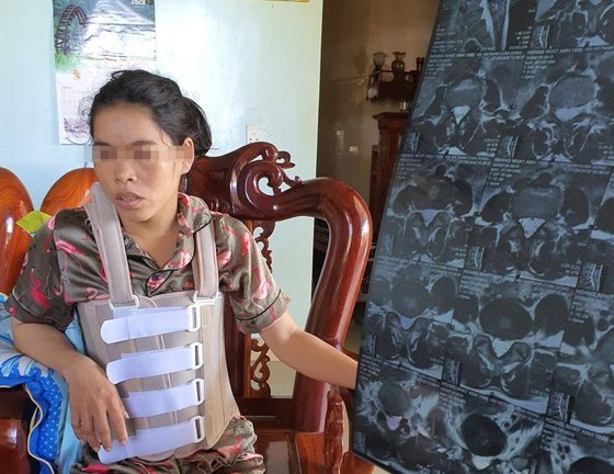 Quảng Bình: Khởi tố người chồng hành hung vợ suốt 11 năm - ảnh 1